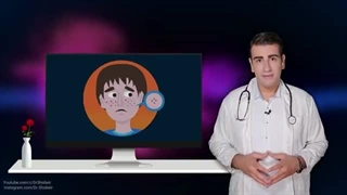 درمان جوش صورت