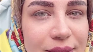مرکز تخصصی ابرو چشم لب