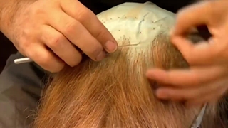 روز جهانی کلاه گیس | 10 مارس