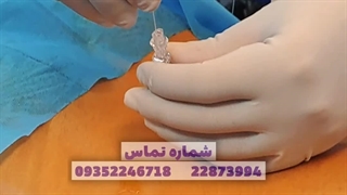 درمان دیسک کمر با لیزر بدون جراحی و بیهوشی . دکتر علی اثنی عشری . متخصص و جراح مغز و اعصاب کلینیک درد مهرگان پاکسازی پوست