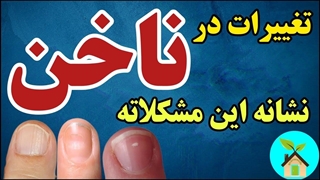 تغییرات در ناخن‌ها نشانه این بیماری‌ها‌ست | نقش ناخن‌ها در سلامتی چیه؟