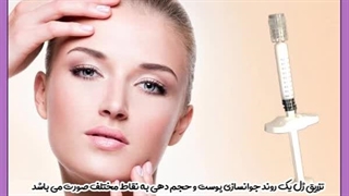 مراقبت های بعد از تزریق ژل عصب‌کشی