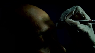 کاشت ابرو برای اقایان در کلینیک سلامت ایده آل