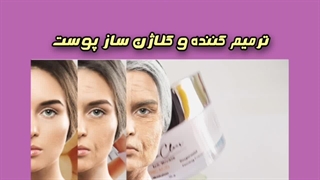 جدیدترین کرم بوتاکس و ضد چروک گلدن کلر /09120750932