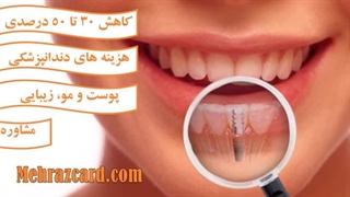 پیوند استخوان در ایمپلنت