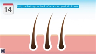 بهترین مرکز لیزر در شیراز کامپوزیت ونیر