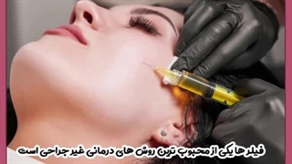 ماندگاری فیلر گونه ماموپلاستی
