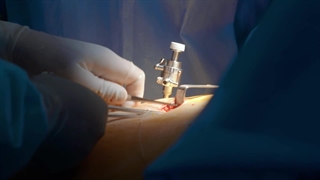 درمان قطعی زانو با زانوبند زاپیامکس | تماس بگیرید 02191324136