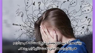 درمان ریزش مو جراحی زیبایی پلک