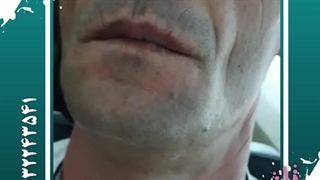 کلینیک تزریق ژل در کرج