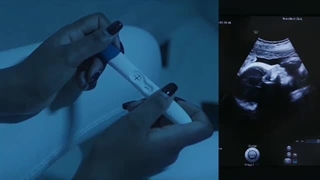 استرس در بارداری و حاملگی