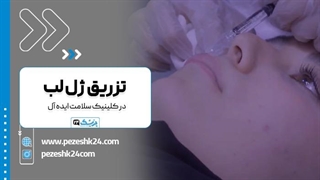 کلینیک سلامت ایده آل بهترین کلینیک تزریق ژل لب