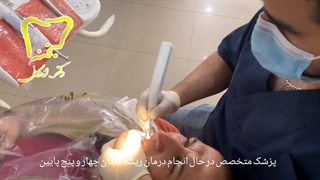 درمان ریشه دندان