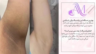 میخوای سیاهی زیر بغل و واژنت رو سفید کنی