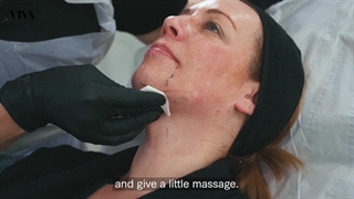 ویدئوی انجام مزوتراپی غبغب +| آپدیت 1403|