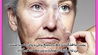 تاثیر استرس بر پیری پوست کاشت ریش