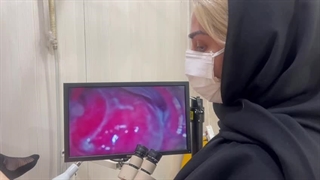 فیلم واقعی زخم دهانه رحم در بیماری مبتلا به عفونت مکرر + توضیجات کامل راجع به عوارض درمان نکردن زخم