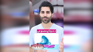 تفاوت عمده دندان مصنوعی و ایمپلنت