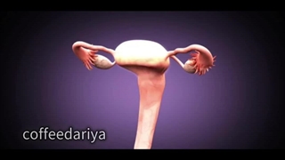 پیشگیری از ابتلا به سرطان رحم