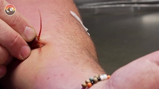 لحظه‌ای که هزارپای غول پیکر آسیایی یک کارشناس حیات وحش را نیش می زند