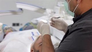 ترمیم سطحی دندان در کلینیک بارانا