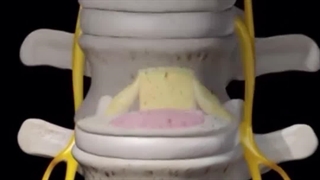 بهترین روش درمان درد با کمربند پلاتینر | تماس بگیرید : 02191324136