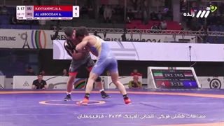 امین کاویانی یک دندان مصنوعی