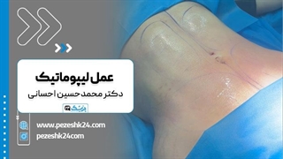 دکتر محمد حسین احسانی بهترین جراح لیپوماتیک تهران