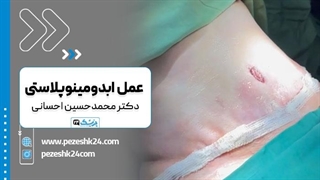 دکتر محمد حسین احسانی بهترین جراح ابدومینوپلاستی تهران لیزر موهای زائد