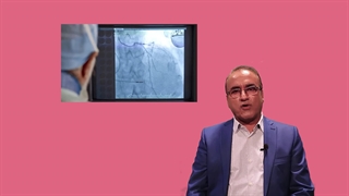 آنژیوگرافی و آنژیوپلاستی عروق قلب