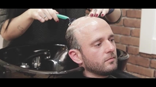 پروتز مو چگونه انجام میشود؟