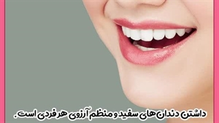 سفید کردن دندان با بلیچینگ اینسایزینگ