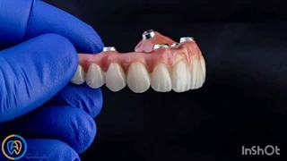 فیلم اوردنچر دندان