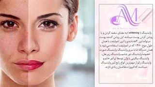 میدونستی لیزر وایتنینگ یا سفیدسازی چقد عوضت میکنه