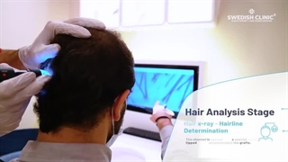 ترمیم مو چیست؟