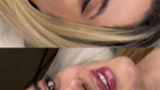 تزریق فیلر لب