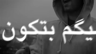 فری استایل فدایی جراحی پف زیر چشم