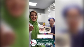 دستیابی به ابروهایی بی نقص با کاشت ابرو