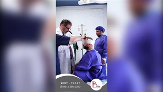 کاشت مو موفق مراجعه کننده از سلیمانیه عراق