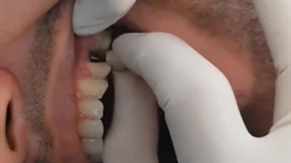 دکتر رضا قاسمی | متخصص ایمپلنت در بندرعباس