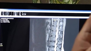 درمان کمردرد با فیزیوتراپی