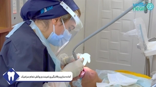 آماده سازی و قالبگیری لمینت و روکش تمام سرامیک - دکتر نگین اثنی عشری لیپوساکشن