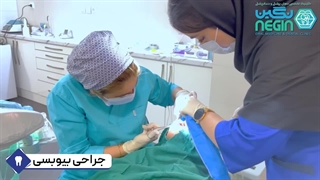 جراحی بیوبسی - دکتر نگین اثنی عشری - متخصص بیماری دهان، فک و صورت رفع افتادگی پلک