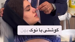 نمونه کار بهترین جراح بینی گوشتی: دکتر شفیعی جراحی فک