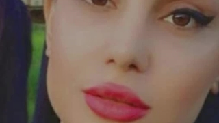 قبل و بعد عمل زیبایی بینی