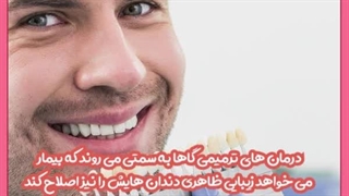 انواع روشهای زیبا سازی دندان