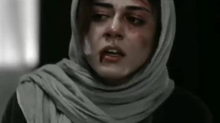 آیا مشاوره قبل از ازدواج ضروری است؟ پروتز سینه