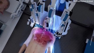 جراحی پیوند سر با استفاده از ربات ها و هوش مصنوعی