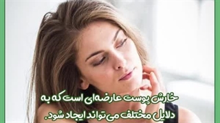 قیمت تراشیدن دندان خرگوشی