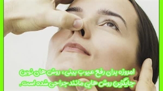 هزینه لیفت بینی با نخ چقدر است؟